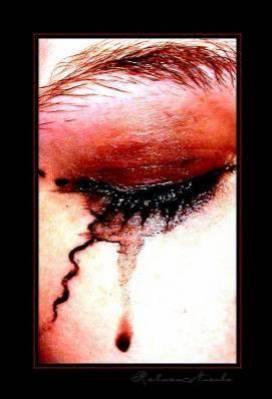 comment faire quand on en a mart et a 30 ans ont veux tous plaqu�s et recommencez!!!!!!!!!!!